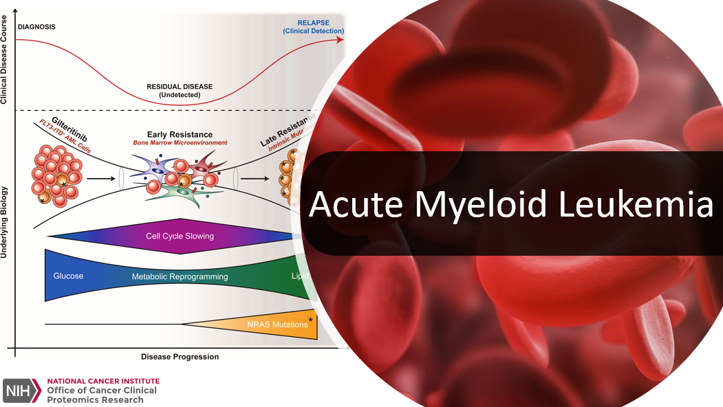 Leukemia Cells In Bone Marrow