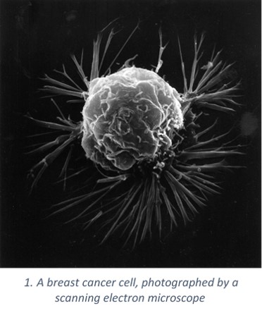 breast cancer cell