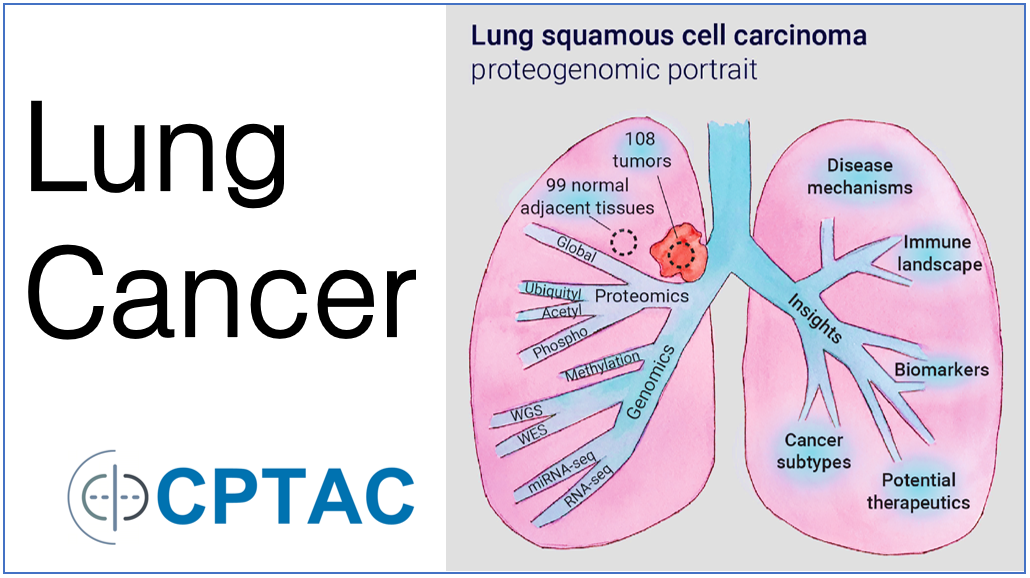 A More Complete Molecular Picture of Lung Squamous Cell Carcinoma Comes