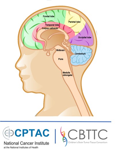 childs brain with CPTAC and CBTTC logos