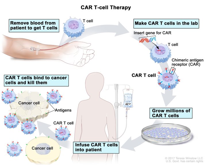 CAR T-cell therapy diagram