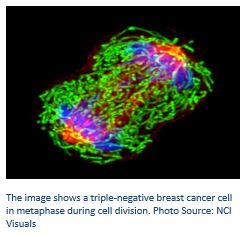 The image shows a triple-negative breast cancer cell in metaphase during cell division.